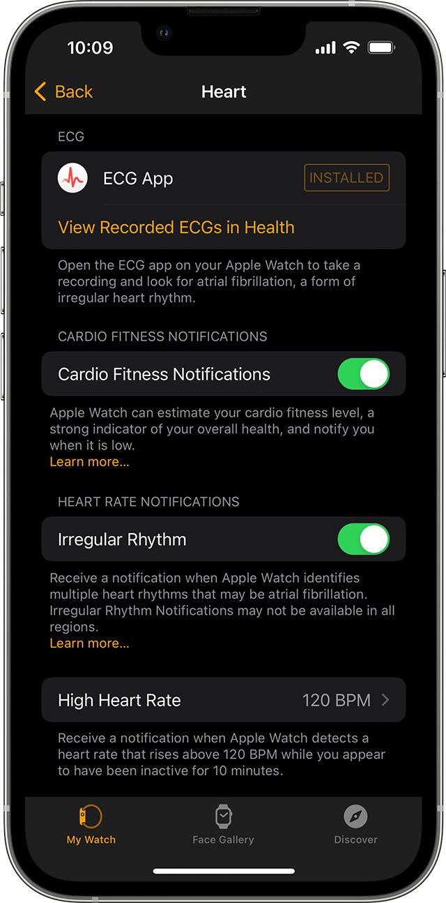 YY易游體育：從健康監(jiān)測到生命守護(hù)：AppleWatch科技創(chuàng)新與人文關(guān)懷交織的十年(圖5)